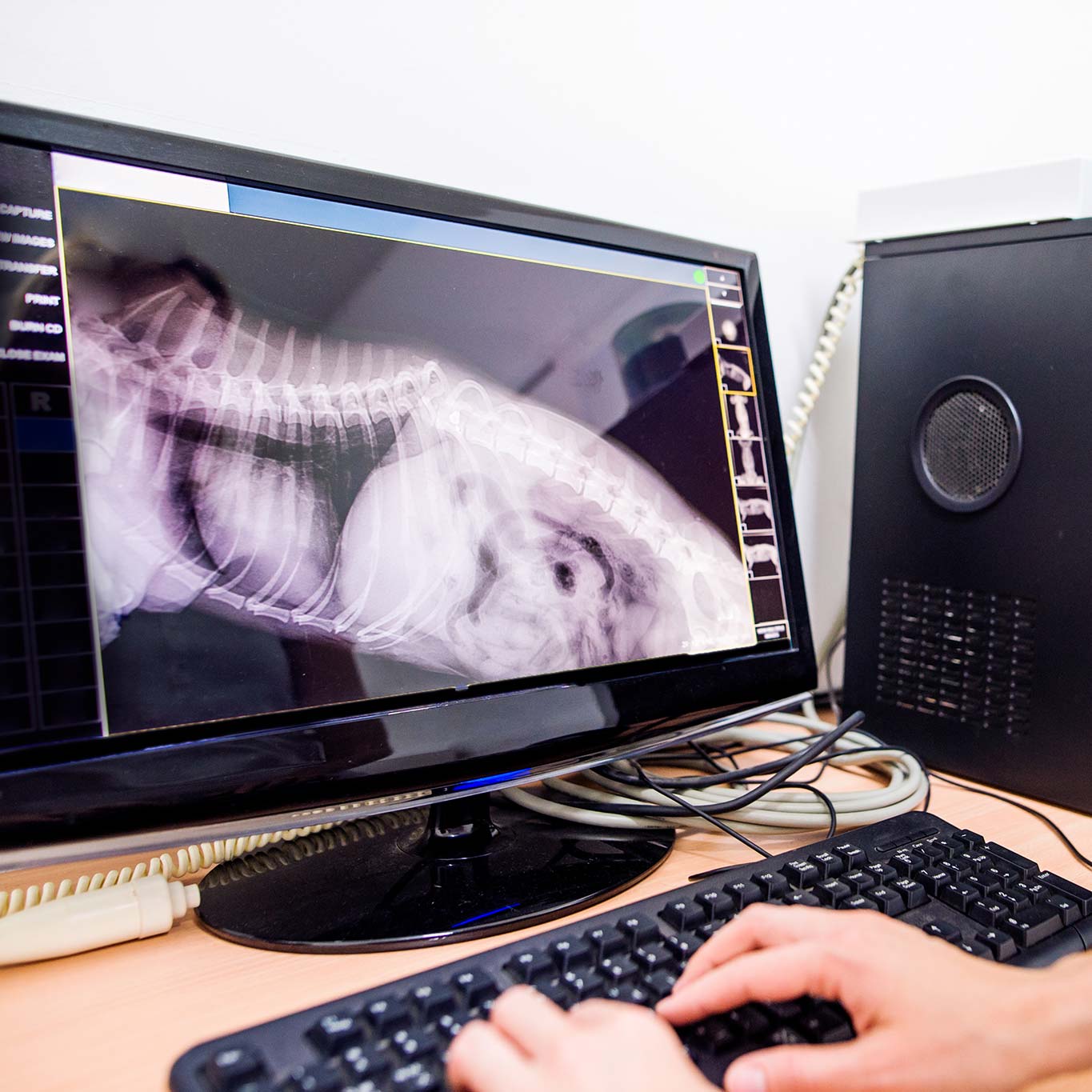 A digital x-ray